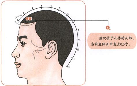 前庭穴 黃星